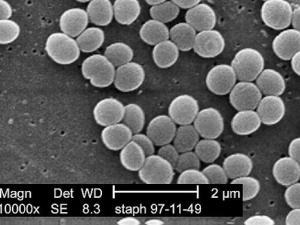 Una cepa de la bacteria Staphylococcus aureus tomada de un cultivo resistente a la vancomicina intermedia (VISA). / CDC/ Matthew J. Arduino, DRPH; Janice Carr (WIKIMEDIA)