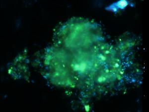Partícula marina con bacterias (en azul) al microscopio. / Mireia Mestre-CSIC 