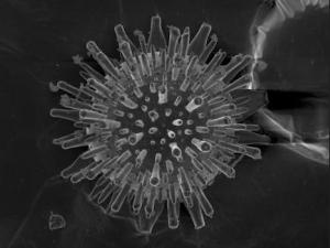 Biomorfo de cal y sílice observados mediante microscopía electrónica de barrido./ CSIC