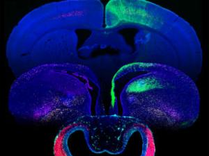 Imágenes de fluorescencia de cortes de cerebro de serpiente (frente), pollo (intermedio) y ratón (detrás) ilustrando las diferencias en grosor, tamaño y cantidad de neuronas en la corteza cerebral (verde). / CSIC-UMH