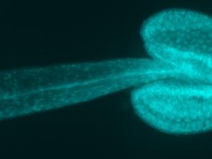 Anteras teñidas con un marcador fluorescente. / Germán Martínez Arias