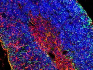 Imagen de un timo, órgano donde se inicia la transformación de las células que generan la leucemia aguda de células T. / CSIC