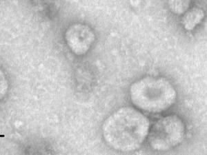 Imagen de vesículas extracelulares, liberadas de células de melanoma metastásico, tomada con un microscopio electrónico del Centro Nacional de Biotecnología. AUTORAS: Carmen Campos, Cristina Patiño y Mar ValésImagen de vesículas extracelulares, liberadas de células de melanoma metastásico, tomada con un microscopio electrónico del Centro Nacional de Biotecnología. AUTORAS: Carmen Campos, Cristina Patiño y Mar Valés