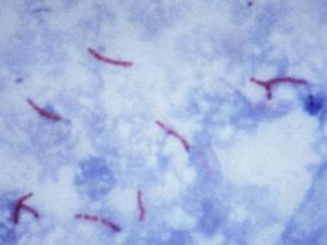 La bacteria Mycobacterium tuberculosis en el esputo de un paciente, visualizada con la tinción de Ziehl-Neelsen. /CSIC