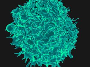Micrografía coloreada de un Linfocito T. / NIAID (FLICKR)