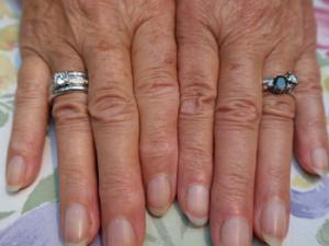 Manos de mujer mayor. / Witizia (PIXABAY)