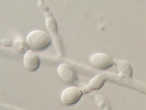 Descubren cómo los mohos resisten a los antibióticos habituales