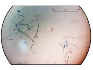 Imagen de microscopio óptico de un filtro después de la filtración de una muestra de sal. / Scientific Reports