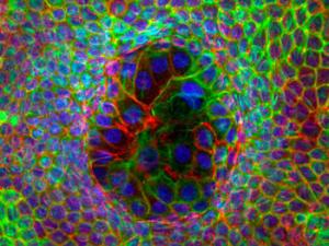 Imagen de células superdeformadas rodeadas por otras mínimamente deformadas. El núcleo celular se muestra en azul, los filamentos de actina en rojo y los filamentos de queratina en verde. / UPC-IBEC