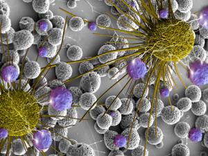 Células de cáncer de cerebro. / Pen State (FLICKR)