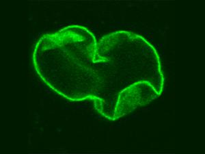 En pacientes con HGPS, el núcleo celular tiene una morfología aberrante. / Paola Scaffidi et al. Plos Biology. DOI: 10.1371/journal.pbio.0030395 (WIKIMEDIA)