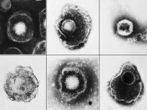 Varios virus de la familia Herpesviridae vistos usando una micrografía electrónica. Entre estos miembros está la varicela-zoster (varicela) y el herpes simple tipo 1 y 2 (HSV-1, HSV-2). / CDC/ E. L. Palmer (PIXABAY)
