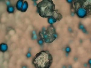 Tratamientos de cancer específicos descubiertos por la Estación Espacial. / (NASA, Estación Espacial Internacional, 26/02/14) 