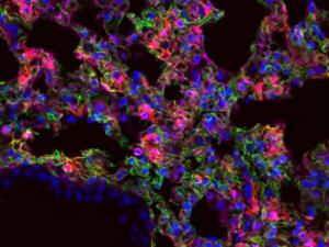 Los investigadores del MIT han diseñado nanopartículas que pueden transportar y suministrar ARN mensajero a órganos específicos. En esta imagen, células de pulmón expresando el ARNm sintético, que aquí se distingue por su tonalidad rojiza. / Piotr Kowalski