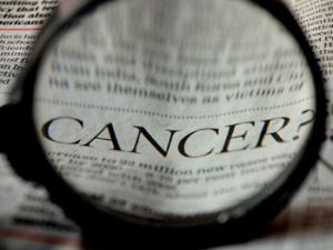 Revelan el mecanismo molecular de la activación de proteínas G por GIV, una proteína promotora de la metástasis. / PDPics (PIXABAY)