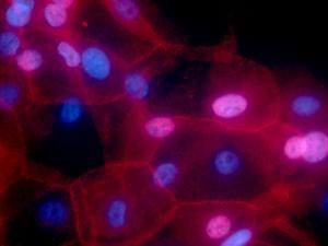 Nuevo dispositivo para detectar células tumorales en la sangre