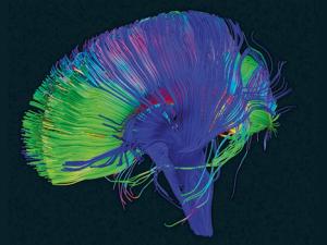 Vías neuronales del cerebro reconstruidas utilizando la tractografía, una técnica para modelar dt-MRI que resalta áreas de actividad y estructura del cerebro. / P. Basser - NICHD (FLICKR)
