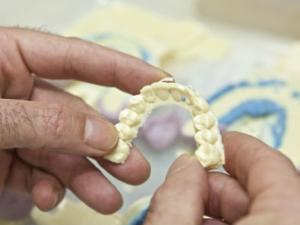 Moldes dentales de pigmeos Baka. / Roberto Ruiz (UA) 