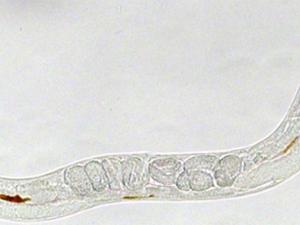 Imagen del C.elegans mostrando las nanopartículas de óxido de hierro en su interior (en color marrón). / Sincrotrón ALBA, ICMAB