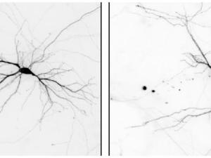 Las imágenes muestran neuronas preparadas a partir de cerebros de ratones de control (izquierda) y ratones sin el gen Nek7. Las dendritas son más cortas y están menos ramificadas en las neuronas de ratones sin NEK7. / IRB Barcelona