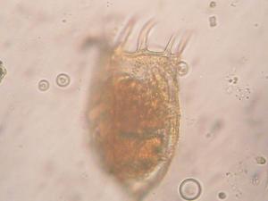 Protozoo ciliato. / Lino M (FLICKR)