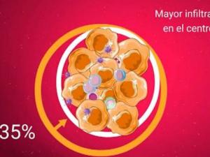 Efectos de Celyvir, el nuevo tratamiento que ha demostrado el efecto antitumoral de virus oncolíticos escondidos en células madre mesenquimales. / ISCIII
