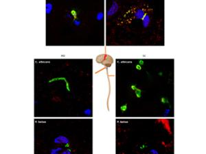 Presencia de estructuras fúngicas en distintas partes del SNC de un paciente de ELA detectadas mediante inmunohistoquímica. / UAM