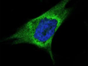 Expresión de LOXL2 en una línea celular de carcinoma de mama de tipo basal,  mostrando la intensa tinción de LOXL2 (verde) rodeando al núcleo (azul). /UAM