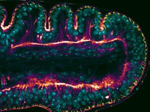 Disco imaginal de pata de Drosophila melanogaster. Parte superior: pliegues epiteliales que prefiguran las articulaciones adultas. Parte inferior: eliminar la función de Dysf impide la formación de los pliegues y de las futuras articulaciones. / UAM-CBMSO