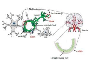 Células, con especial sensibilidad al oxígeno, involucradas en el deterioro del tejido cerebral después de la isquemia. /UAM