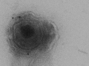 Inmunoelectromicroscopía de microvesículas obtenidas a partir de células HOG infectadas con HSV-1. La imagen muestra una microvesícula (marcada con un anticuerpo anti HSV-1 acoplado a oro coloidal) conteniendo un virión