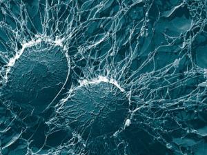 Staphylococcus aureus. / Eric Erbe, Christopher Pooley (WIKIMEDIA)