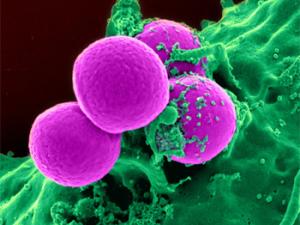 Glóbulos blancos. / skeeze (PIXABAY)