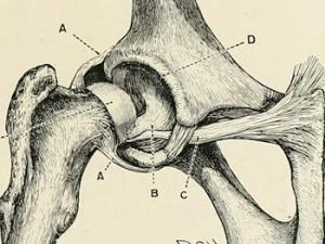 Una investigación demuestra que la fisioterapia reduce el dolor y mejora la movilidad y la capacidad funcional de los pacientes con artrosis de cadera