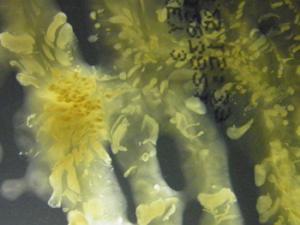 Bacterias encontradas en enfermos de fibrosis quística pulmonar. / Rosa del Campo. Servicio de Microbiología del Instituto Ramón y Cajal de Investigación Sanitaria (IRYCIS)