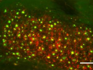 Sección de cerebro de un ratón transgénico para EA mostrando acumulaciones de placas amiloides (verde) y ferritina (rojo). Barra de escala: 100&micro;m. / ACS Chem. Neurosci., 2018, 9 (5), pp 912–924