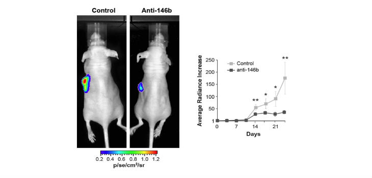 Células tumorales tiroideas humanas se inyectan en el ratón para generar un tumor. El tamaño del tumor disminuye, respecto al control, en los animales en los que se bloquea el microRNA-146b. Derecha: cuantificación del crecimiento en el transcurso del tratamiento. / UAM