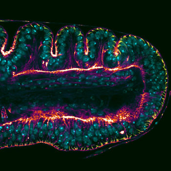 Disco imaginal de pata de Drosophila melanogaster. Parte superior: pliegues epiteliales que prefiguran las articulaciones adultas. Parte inferior: eliminar la función de Dysf impide la formación de los pliegues y de las futuras articulaciones. / UAM-CBMSO
