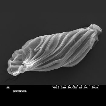 Semilla de Bulbophyllum falcatum (Lindl.), vista al microscopio electrónico de barrido (MEB) del Servicio Interdepartamental de Investigación (SIDI) de la UAM. / UAM