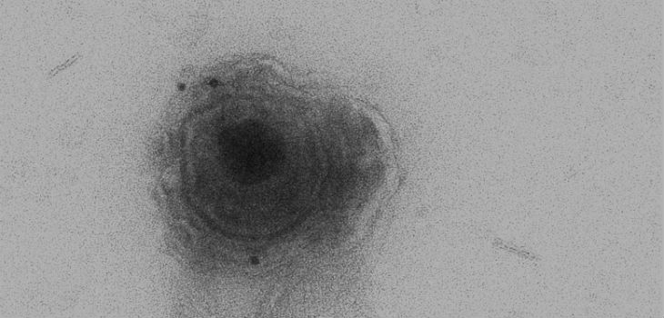Inmunoelectromicroscopía de microvesículas obtenidas a partir de células HOG infectadas con HSV-1. La imagen muestra una microvesícula (marcada con un anticuerpo anti HSV-1 acoplado a oro coloidal) conteniendo un virión