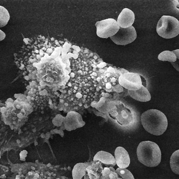 La plasticidad de los macrófagos permite reparar tejidos del pulmón y del hígado