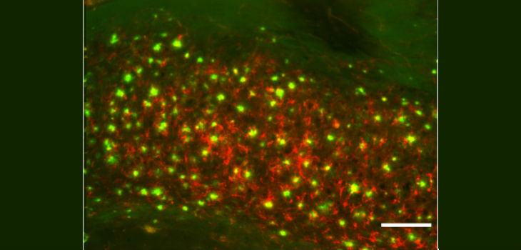 Sección de cerebro de un ratón transgénico para EA mostrando acumulaciones de placas amiloides (verde) y ferritina (rojo). Barra de escala: 100&micro;m. / ACS Chem. Neurosci., 2018, 9 (5), pp 912–924